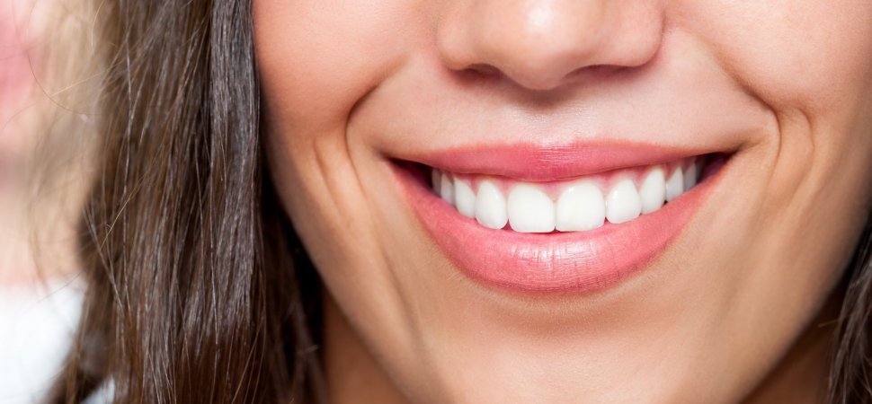dental implants smile